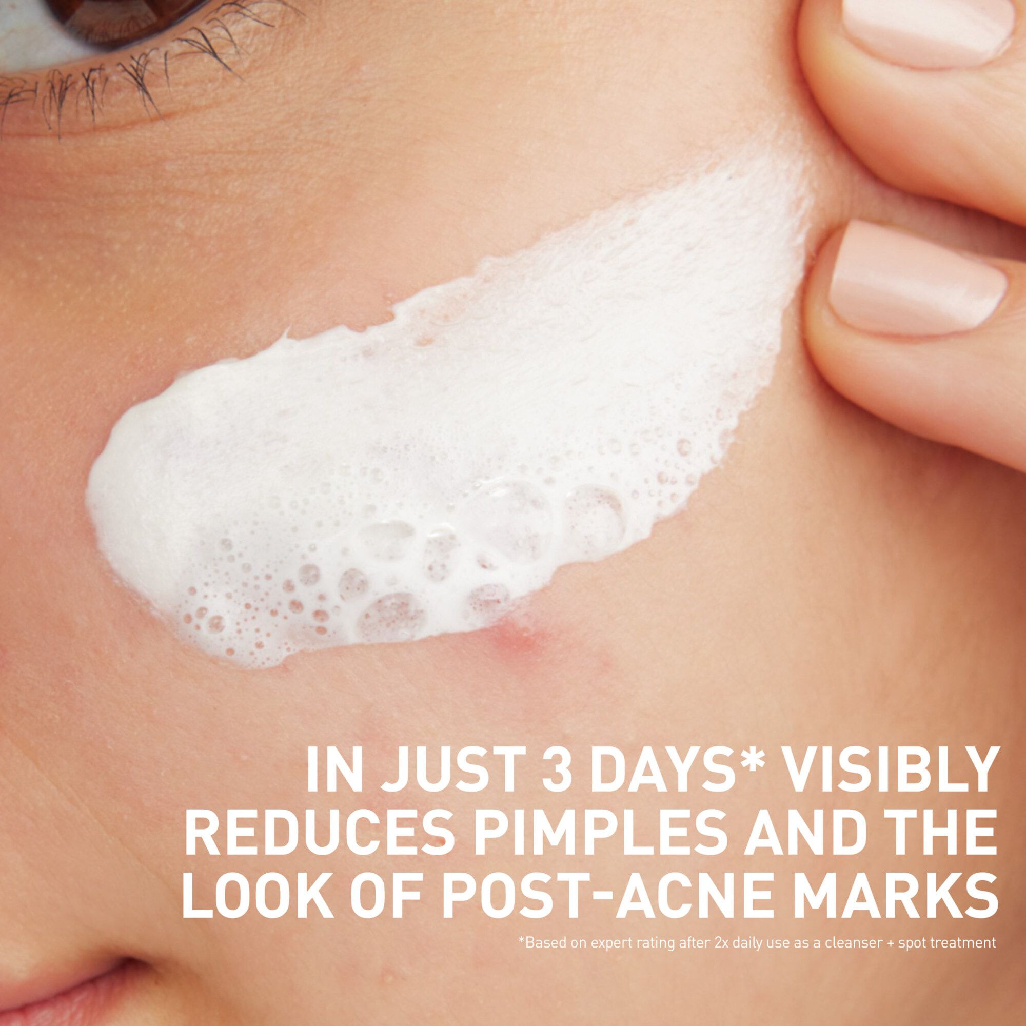 CeraVe® Acne Clay to Foam Cleanser, , large