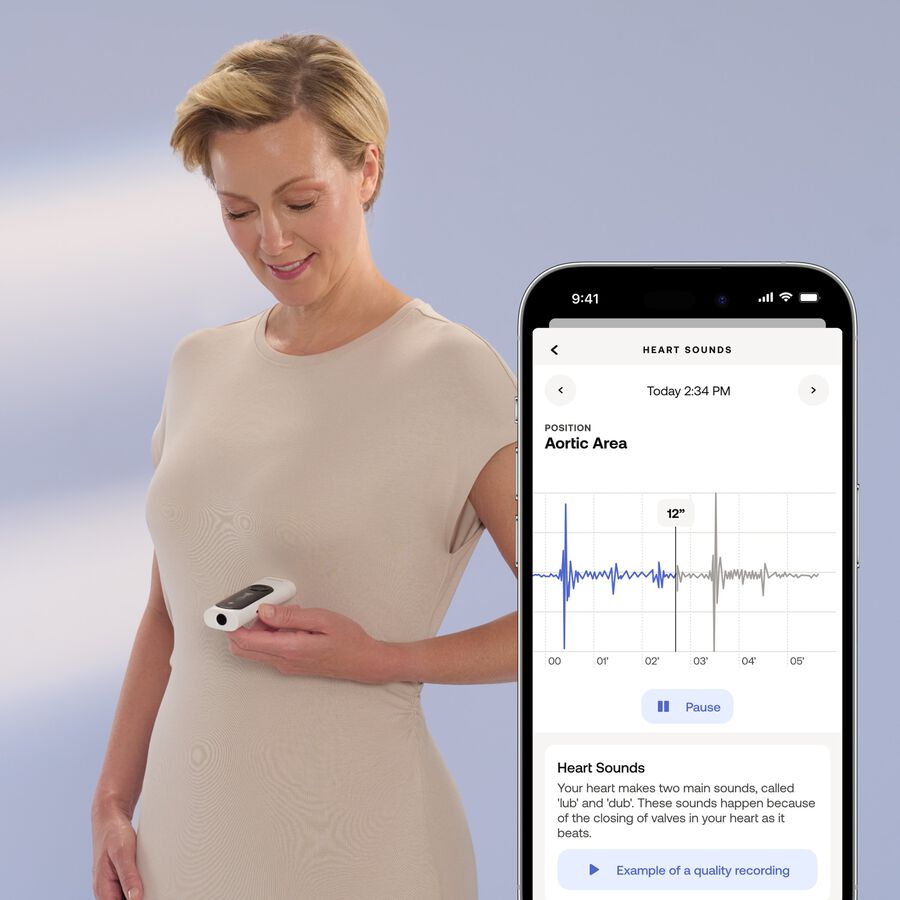 Withings BeamO 3-In-1 Complete Health Monitoring Tool, , large image number 4
