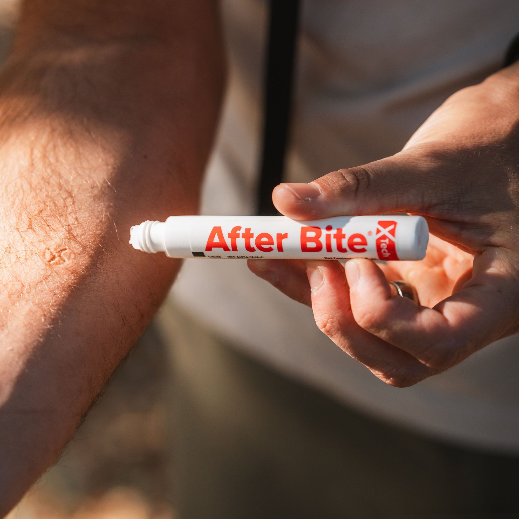 After Bite X-Tech Targeted Itch Relief Treatment, , large