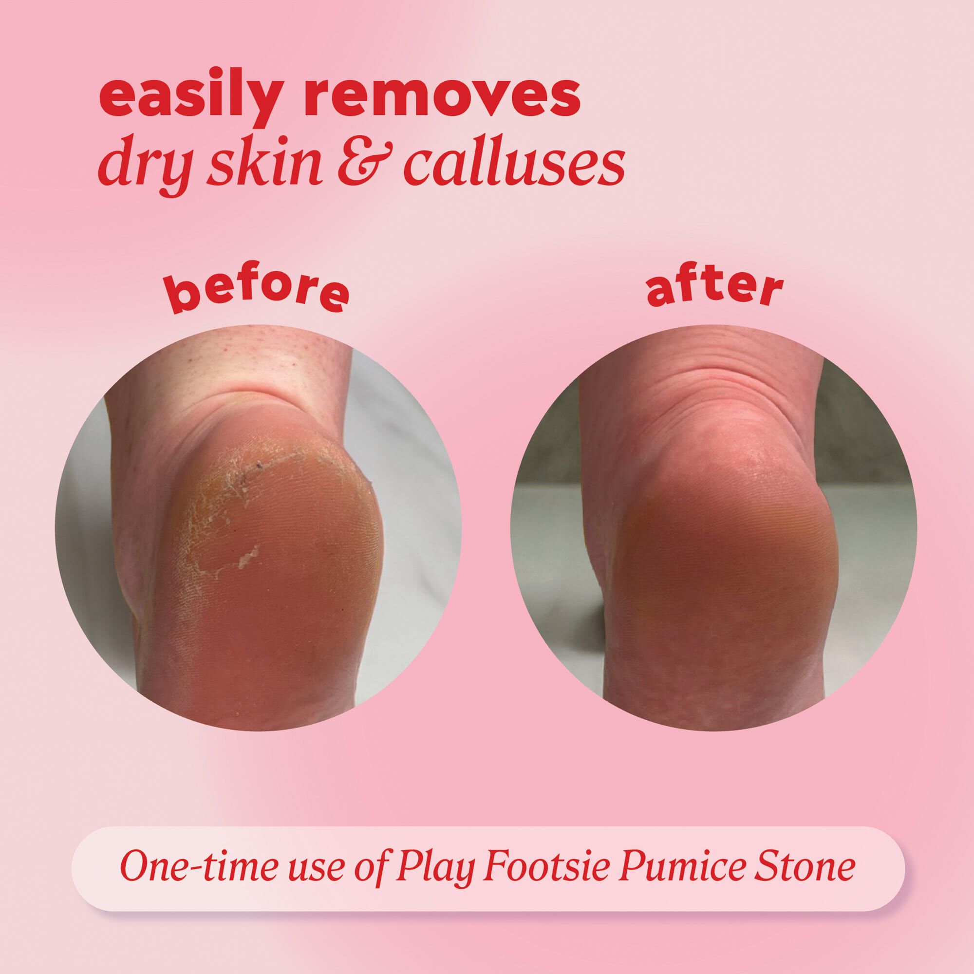 ONYX Professional Play Footsie Double-Sided Pumice Stone, , large