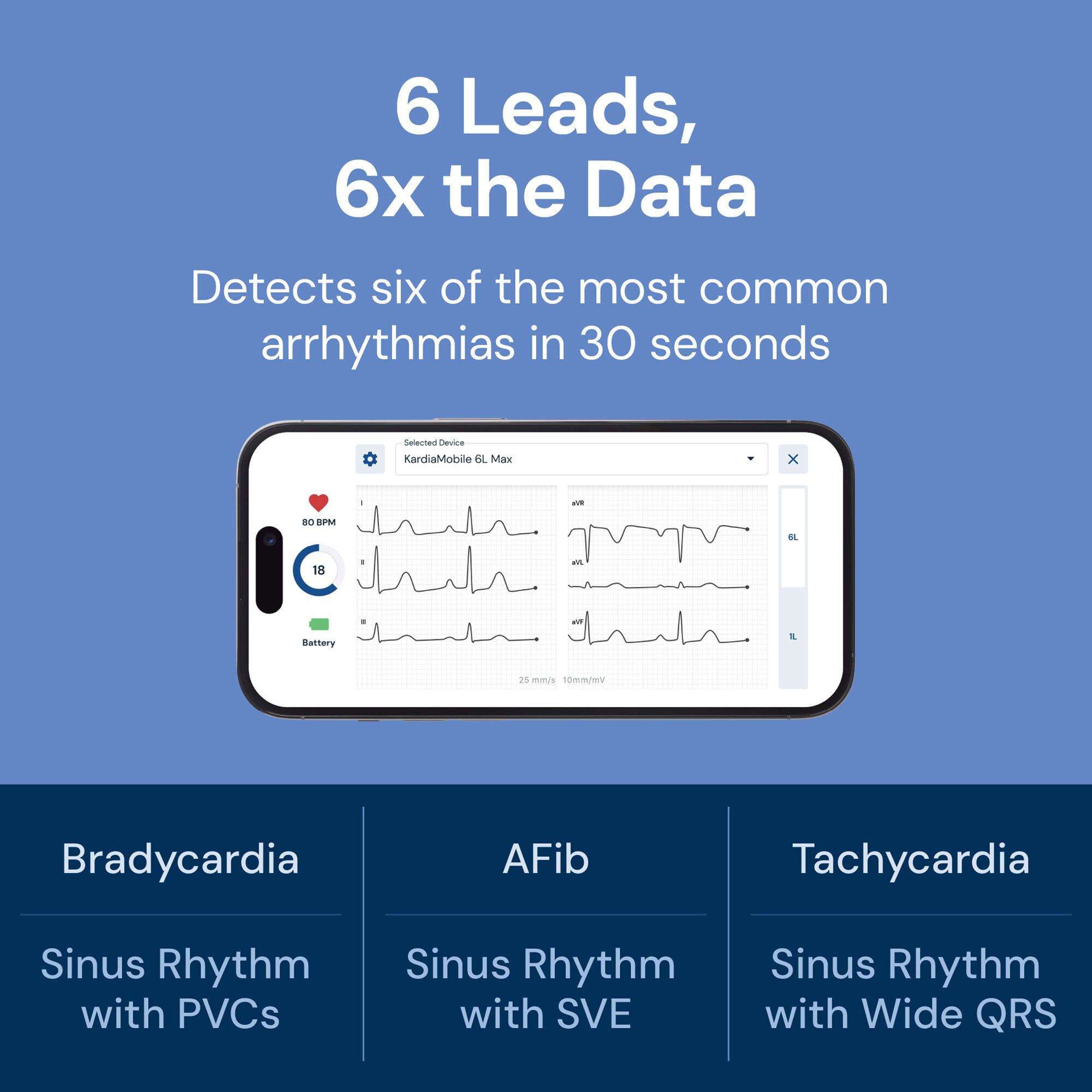 KardiaMobile 6L Max 6-Lead Personal EKG with 1-Year KardiaCare Subscription, , large