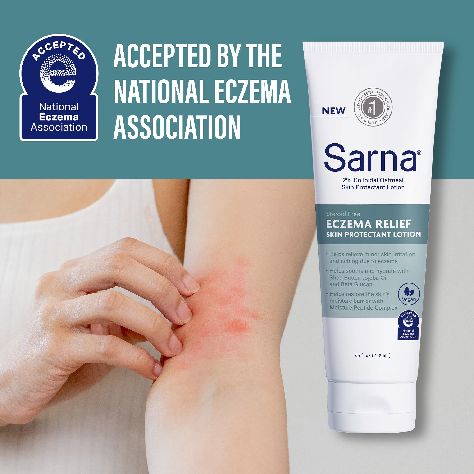 Sarna Eczema Relief Lotion 7.5 oz., , large